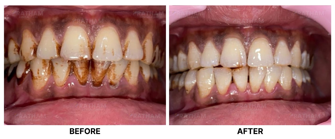 WhatsApp Image 2026-02-20 at 09.30.58